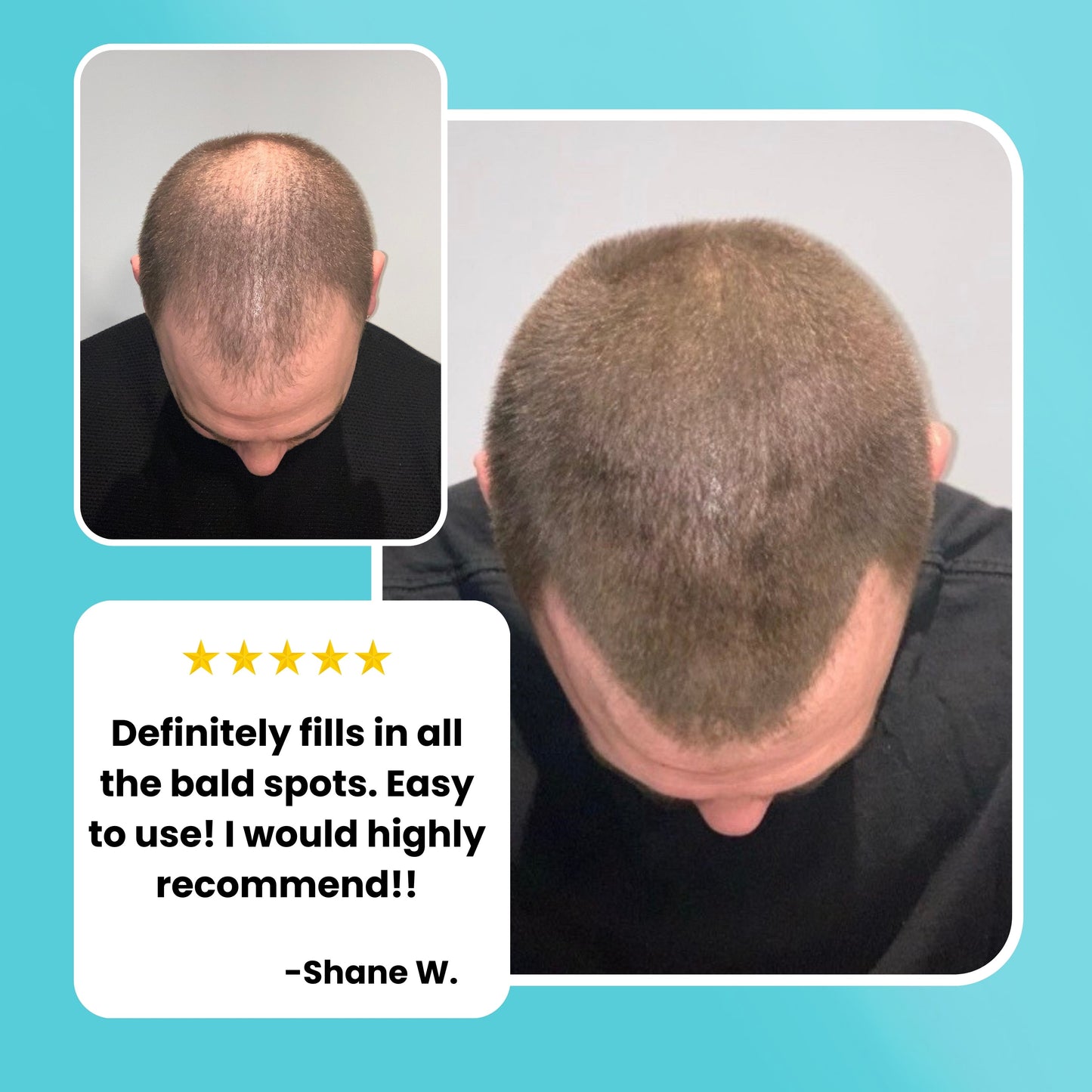 SureThik® Hair Thickening Fibers (30g / 1.06oz) - Beauty image 4