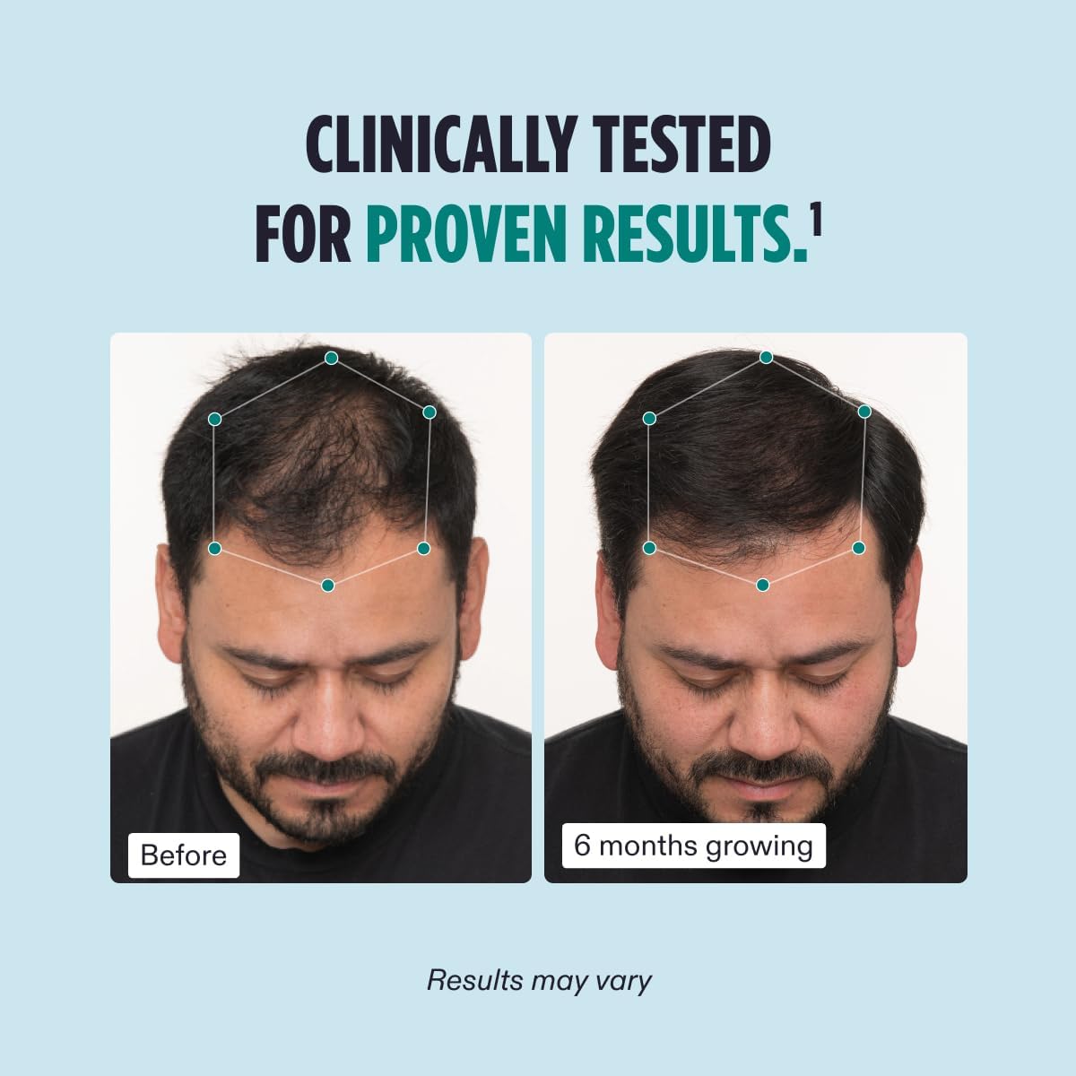 Nutrafol Men Hair Growth Supplement for Thicker - Beauty image 4