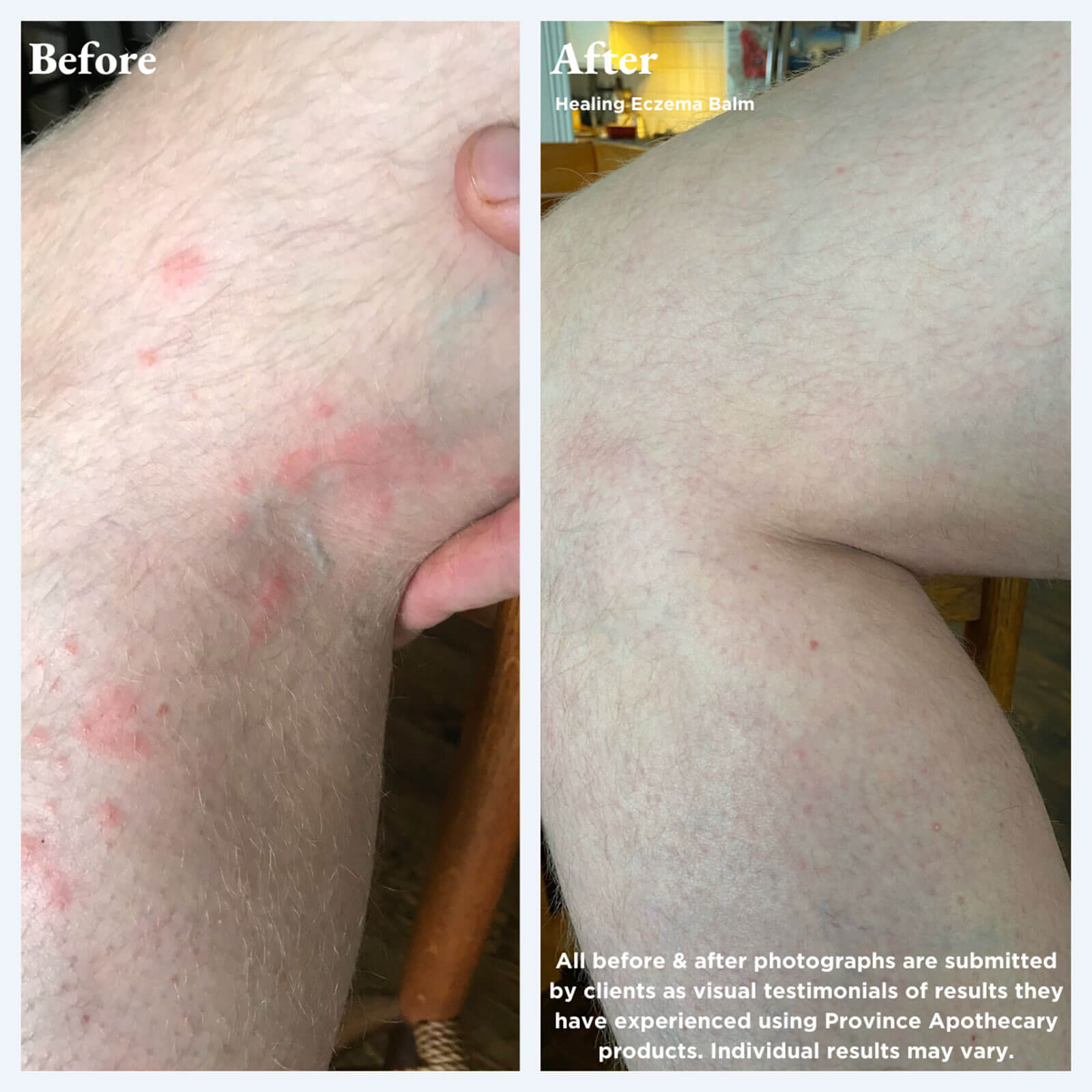 Healing Eczema Balm - Misc image 4