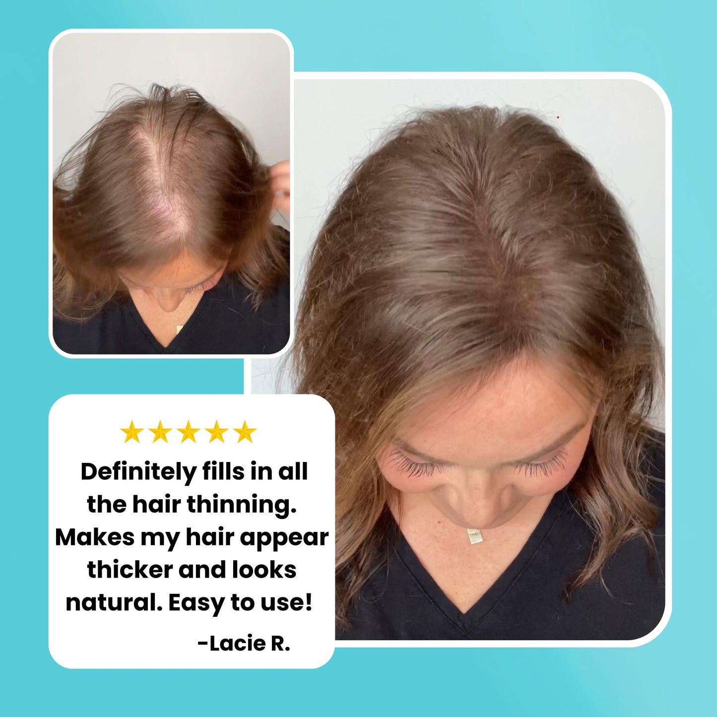 SureThik® Hair Thickening Fibers (30g / 1.06oz) - Beauty image 3