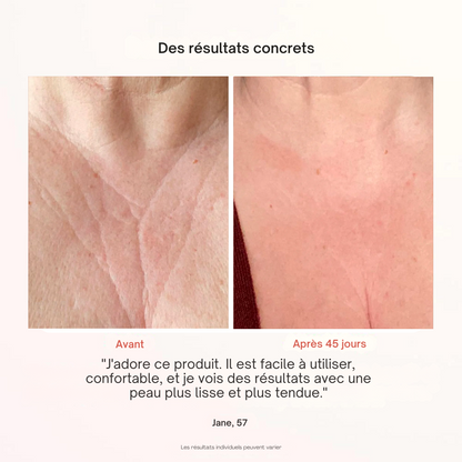 Masque Professionnel de Photothérapie - Misc image 14