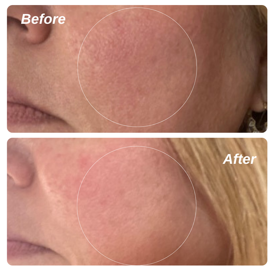 5% Vita C + Ceramides for Sensitive Skin - Beauty image 4