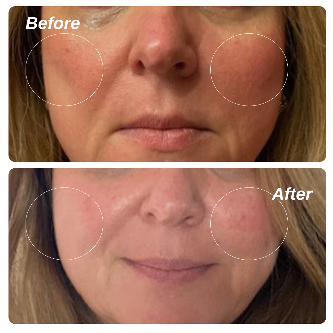 5% Vita C + Ceramides for Sensitive Skin - Beauty image 3
