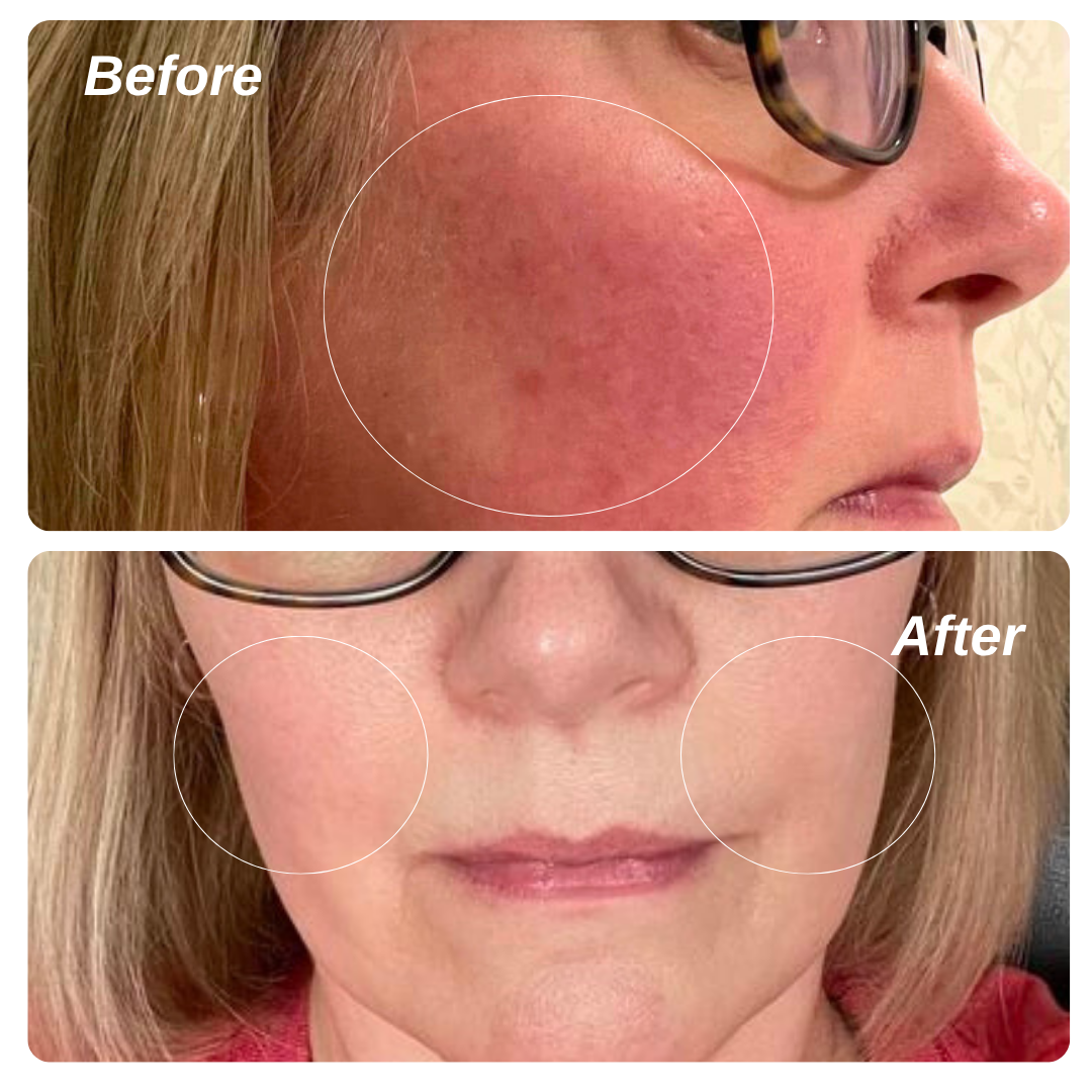 Ruddi Redness Control 1.7oz (50ml) - Kitchen & Dining image 6