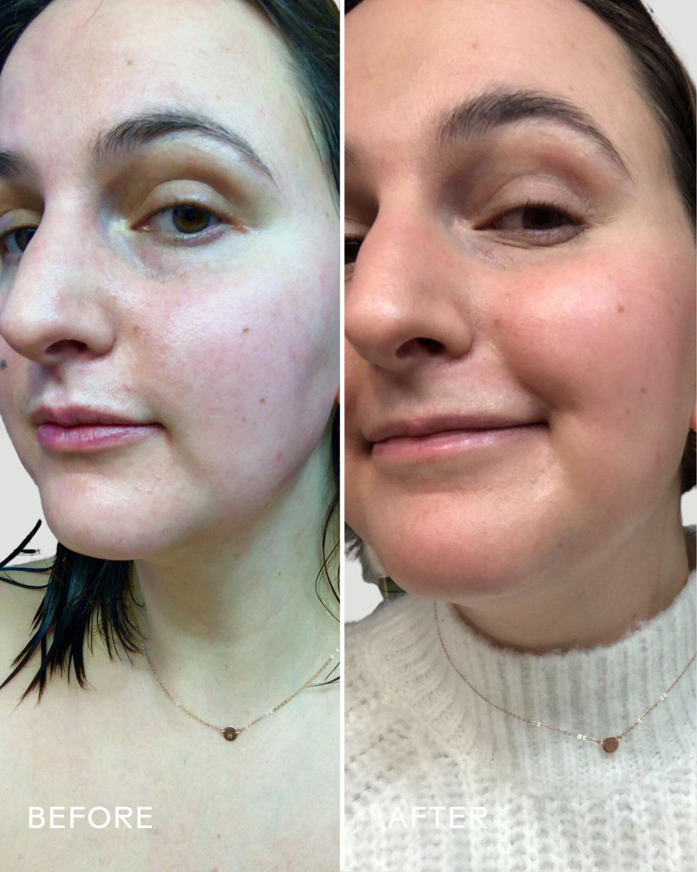 SkinHero™ Calendula + 2% Bakuchiol Bio-Retinol Serum - Misc image 5