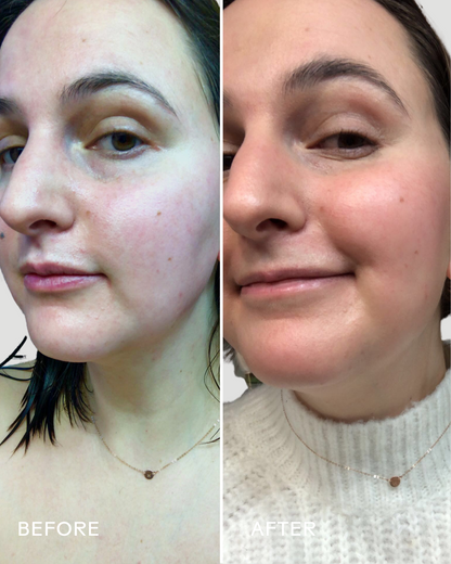 SkinHero™ Calendula + 2% Bakuchiol Bio-Retinol Serum - Misc image 5