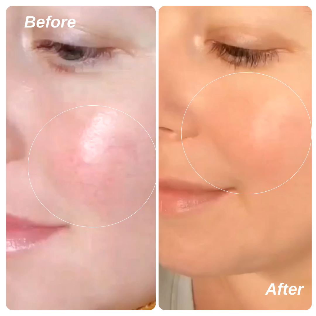 Ruddi Redness Control 1.7oz (50ml) - Kitchen & Dining image 7