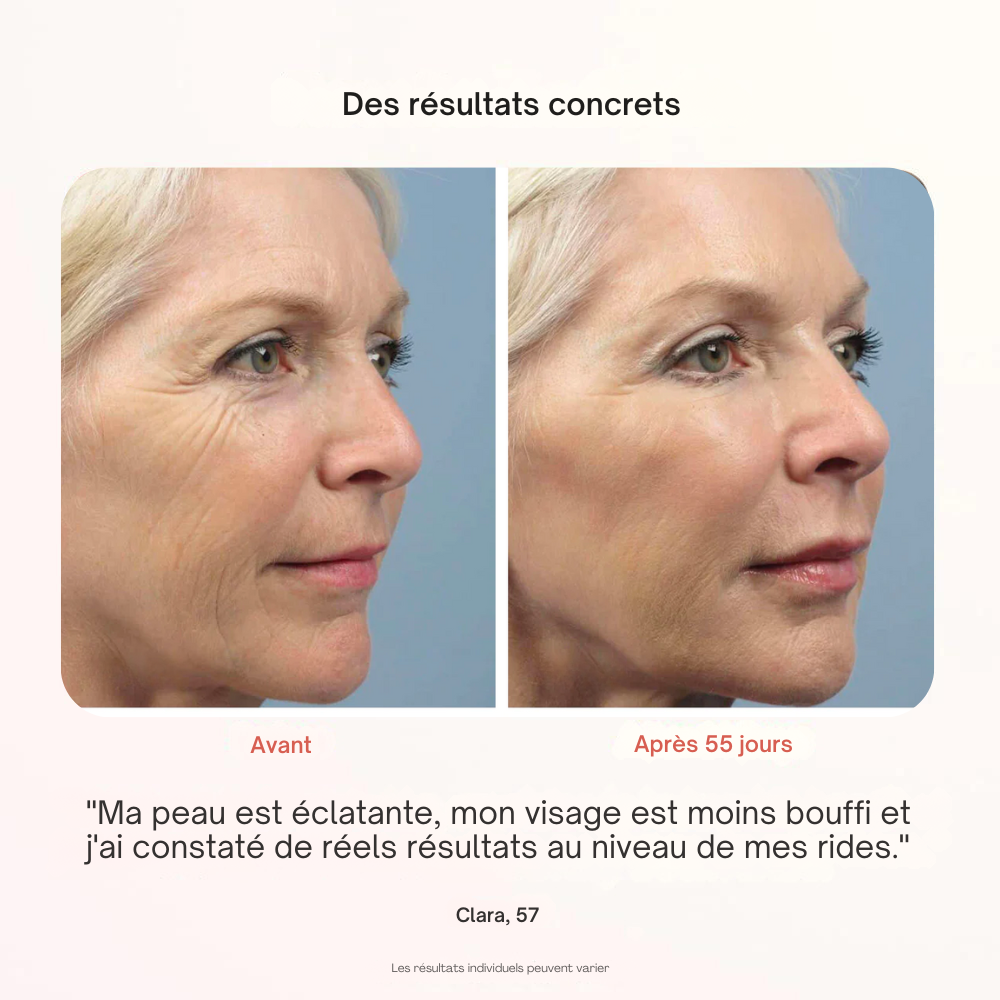 Masque Professionnel de Photothérapie - Misc image 4