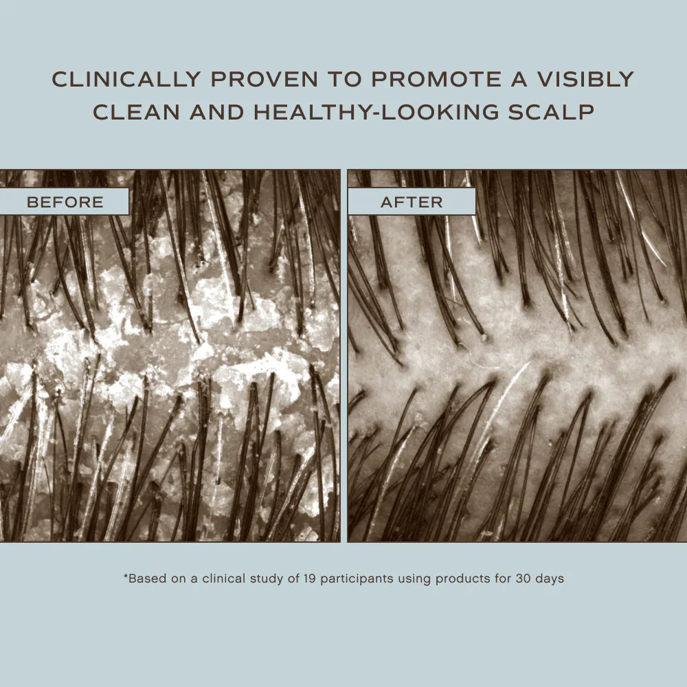 Hair Renew Scalp Hairbath - Misc image 2