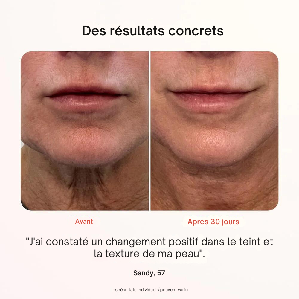 Masque Professionnel de Photothérapie - Misc image 5