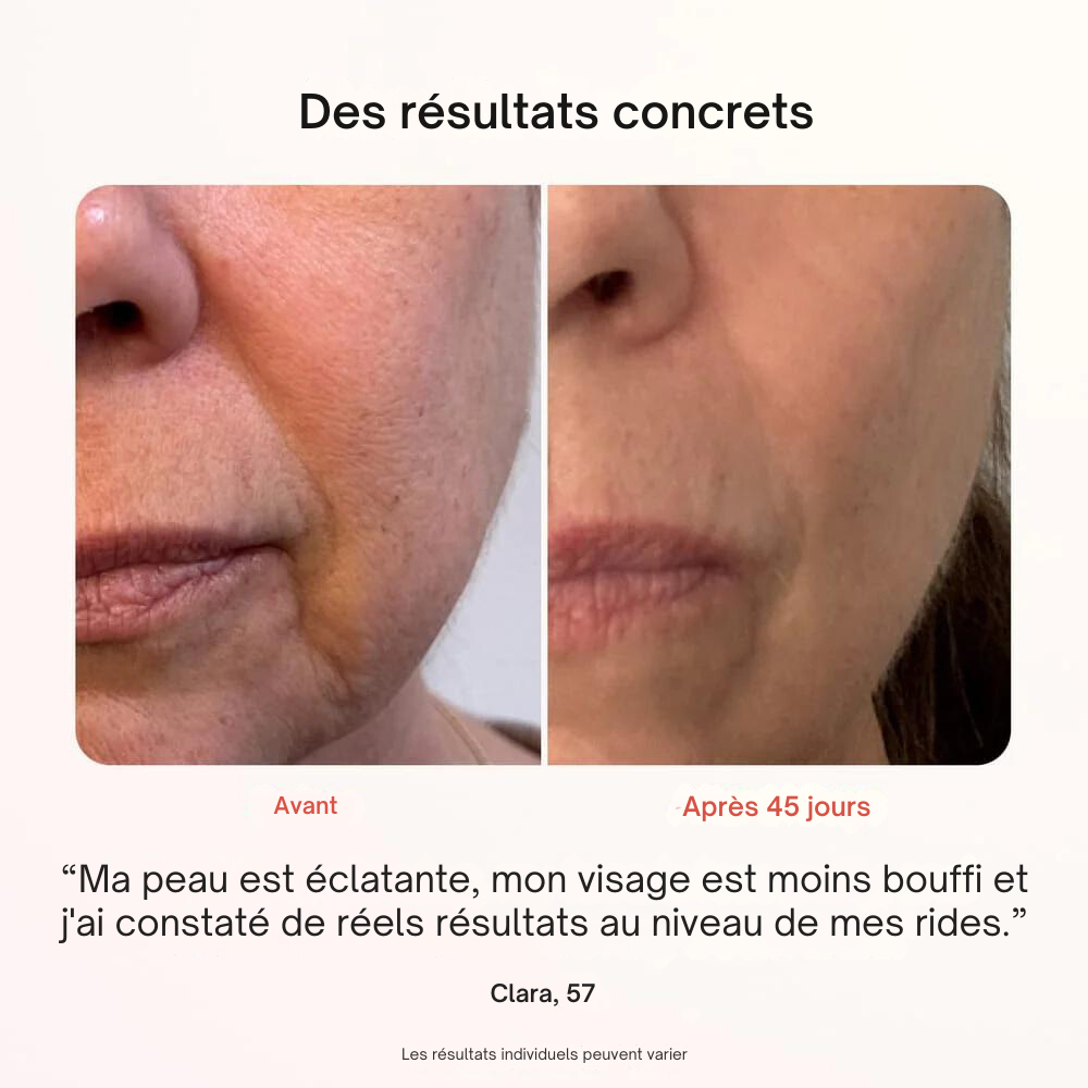 Masque Professionnel de Photothérapie - Misc image 6