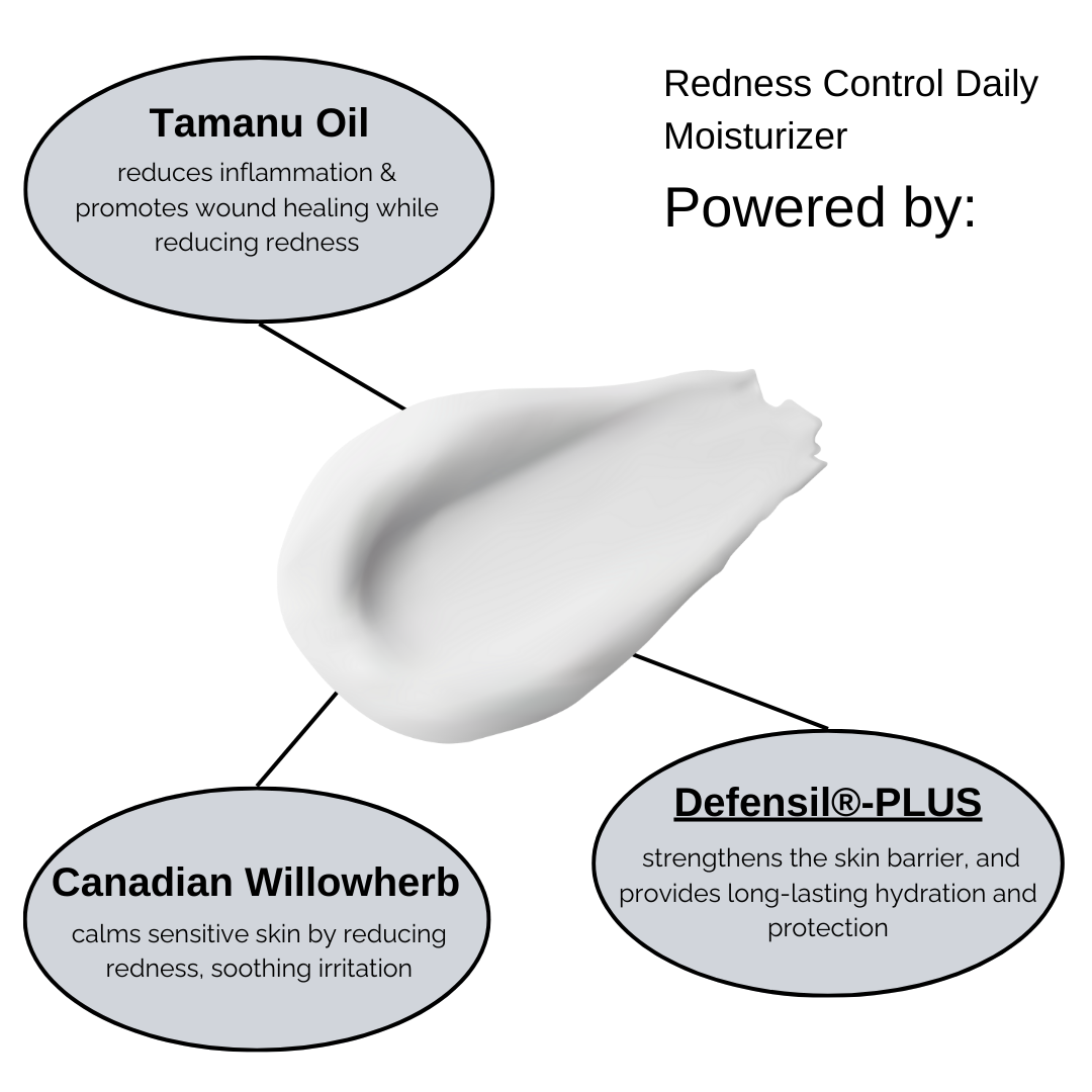 Ruddi Redness Control 1.7oz (50ml) - Kitchen & Dining image 3